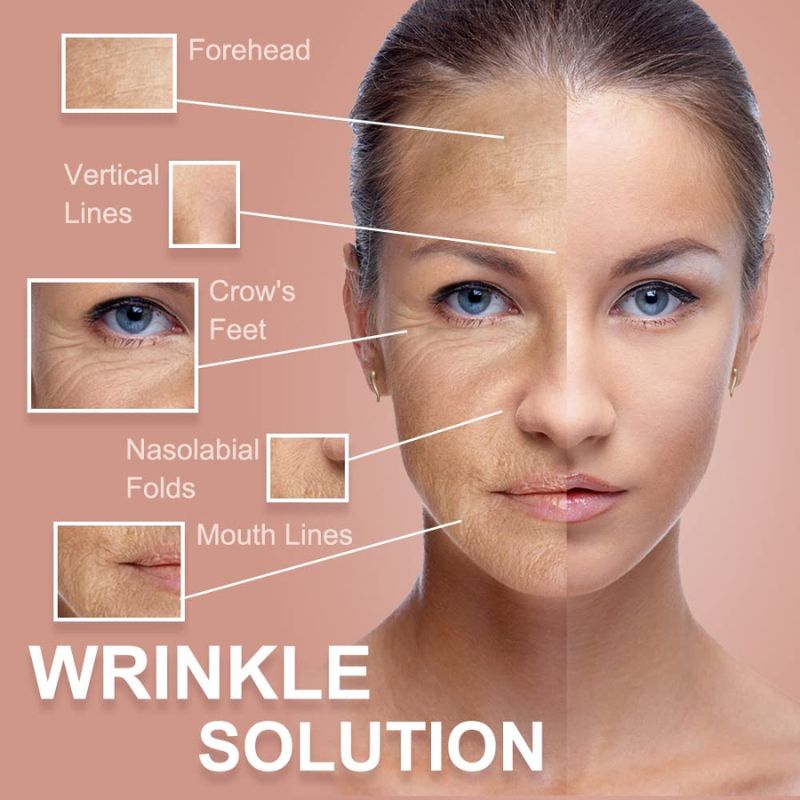Medical Anti-Wrinkle Tape