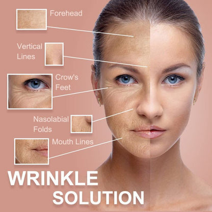 Medical Anti-Wrinkle Tape