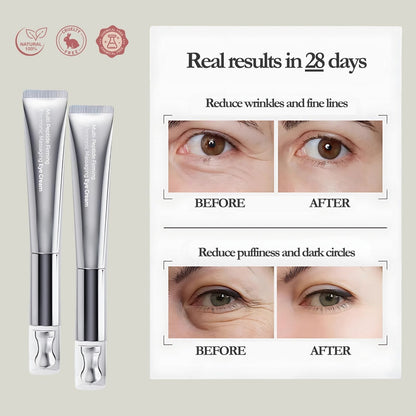 Reedle Shot Lifting Eye Cream